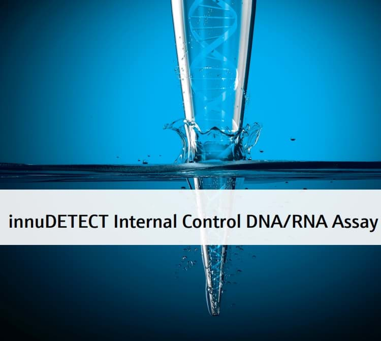 Picture of innuDETECT Internal Control DNA/RNA Assay - 10 reactions of 25 µl